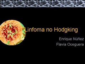 Linfoma no Hodgking Enrique Nez Flavia Oceguera Enrique