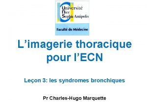 Limagerie thoracique pour lECN Leon 3 les syndromes