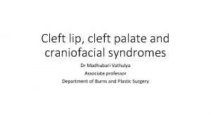 Cleft lip cleft palate and craniofacial syndromes Dr