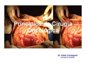 Principios de Ciruga Oncolgica Dr Pablo Carmignani Sanatorio