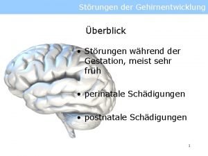 Holoprosenzephalie folsäure Holoprosenzephalie folsäure