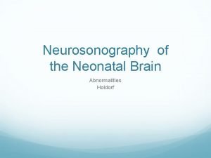 Neurosonography of the Neonatal Brain Abnormalities Holdorf Congenital