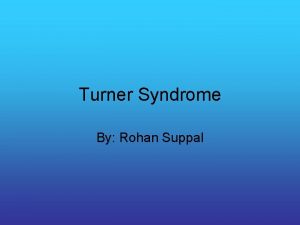 Turner Syndrome By Rohan Suppal What is Turner