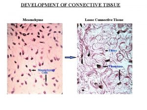 Types of connective tissue