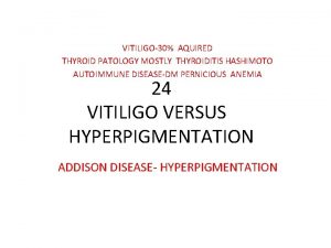 VITILIGO30 AQUIRED THYROID PATOLOGY MOSTLY THYROIDITIS HASHIMOTO AUTOIMMUNE