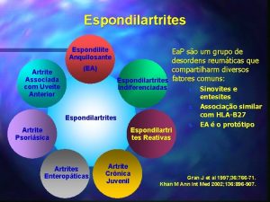 Espondilartrites Espondilite Anquilosante Artrite Associada com Uvete Anterior