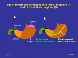 The stomach can be divided into three anatomic