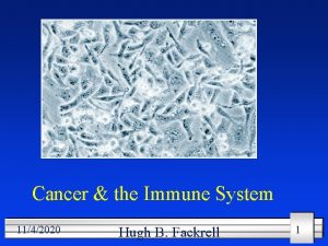 Tumor immunology Tumor immunology
