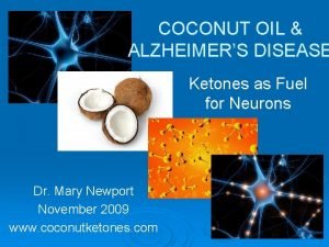 Dr. mary newport coconut oil video