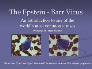 The Epstein Barr Virus An introduction to one