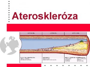 Aterosklerza Co je ATEROSKLERZA Aterom se nazvaj tukov