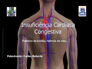 Insuficincia Cardaca Congestiva Falncia da bomba falncia da