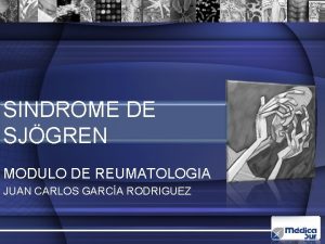 SINDROME DE SJGREN MODULO DE REUMATOLOGIA JUAN CARLOS