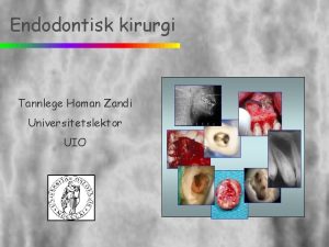 Endodontisk kirurgi Tannlege Homan Zandi Universitetslektor UIO Endodontisk
