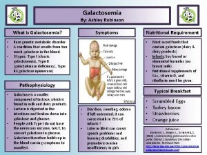 Galactosemia By Ashley Robinson What is Galactosemia Symptoms