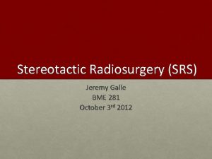 Stereotactic Radiosurgery SRS Jeremy Galle BME 281 October