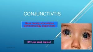 CONJUNCTIVTIS Qena faculty of medicine Ophthalmology Department DR