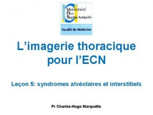 Limagerie thoracique pour lECN Leon 5 syndromes alvolaires