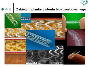 Zabieg implantacji stentu bioabsorbowalnego Zabieg implantacji stentu bioabsorbowalnego