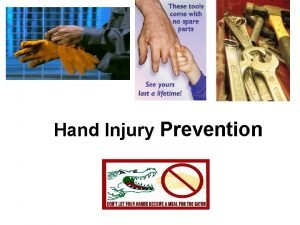 Hand hazards
