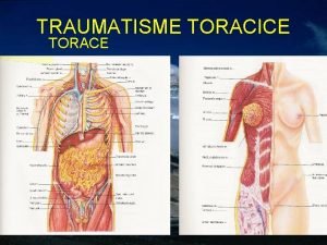 TRAUMATISME TORACICE TORACE TRAUMATISME TORACICE TORACE TORACE CAILE