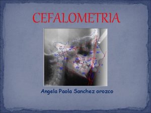 CEFALOMETRIA Angela Paola Sanchez orozco cefalometria es el