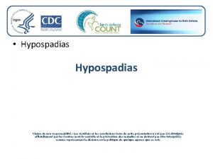 Hypospadias définition