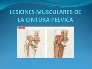 LESIONES MUSCULARES DE LA CINTURA PELVICA INDICE Introduccin