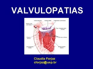 VALVULOPATIAS Claudia Forjaz cforjazusp br VLVULAS 1 Mitral