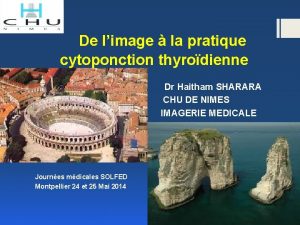 Nodule isoéchogène tirads 3 Nodule isoéchogène tirads 3