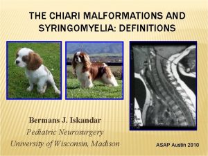 THE CHIARI MALFORMATIONS AND SYRINGOMYELIA DEFINITIONS Bermans J