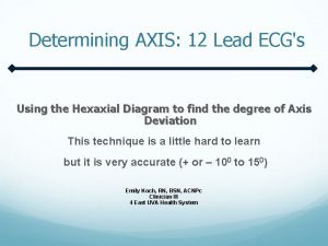 Determining AXIS 12 Lead ECGs Using the Hexaxial