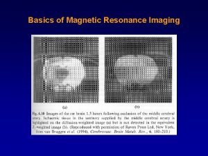 Basics of Magnetic Resonance Imaging Angular Momentum Orbital