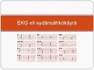Ekg paperin nopeus Ekg paperin nopeus