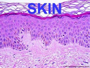 Stasis dermatitis