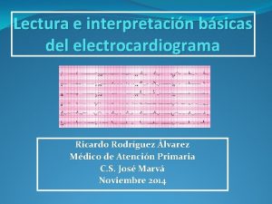 Electrocardiograma valores normales y anormales