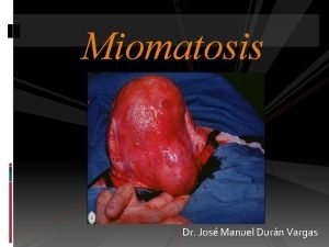 Miomatosis Dr Jos Manuel Durn Vargas Mioma Uterino