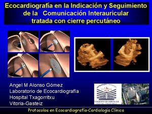 Ecocardiografa en la Indicacin y Seguimiento de la