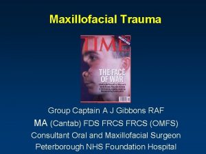 Maxillofacial Trauma Group Captain A J Gibbons RAF