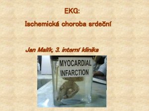 EKG Ischemick choroba srden Jan Malk 3 intern