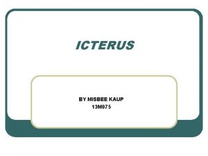 Causes of icterus