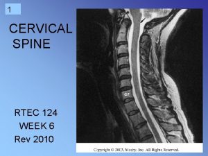 1 CERVICAL SPINE RTEC 124 WEEK 6 Rev