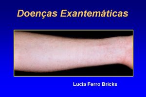 Doenas Exantemticas Lucia Ferro Bricks Varola DNA vrus