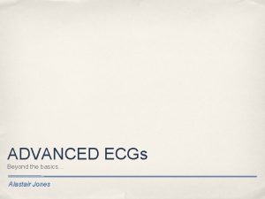 ADVANCED ECGs Beyond the basics Alastair Jones Quiz