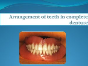 Arrangement of teeth in complete denture