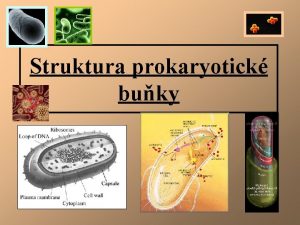 Struktura prokaryotick buky Zkladn struktury Cytoplazmatick membrna Bakteriln