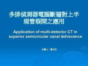 Application of multidetector CT in superior semicircular canal