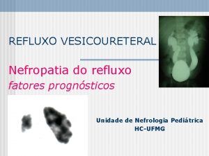 REFLUXO VESICOURETERAL Nefropatia do refluxo fatores prognsticos Unidade