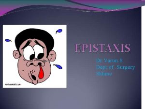 Trotters method in epistaxis