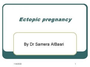 Ectopic pregnancy By Dr Samera Al Basri 1142020